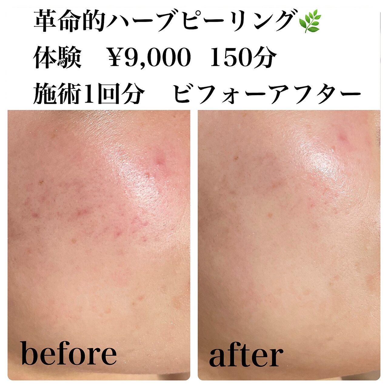 オイルケアオプション